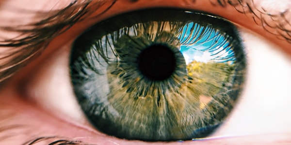 Close-up image of cornea without corneal edema.